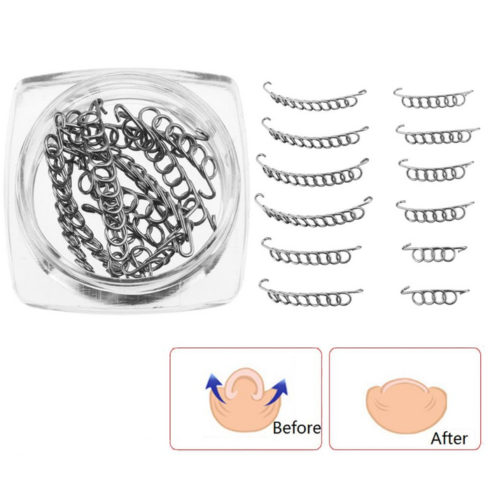 12pcs Ingrown Toe Nail Correction Wire Pedicure
