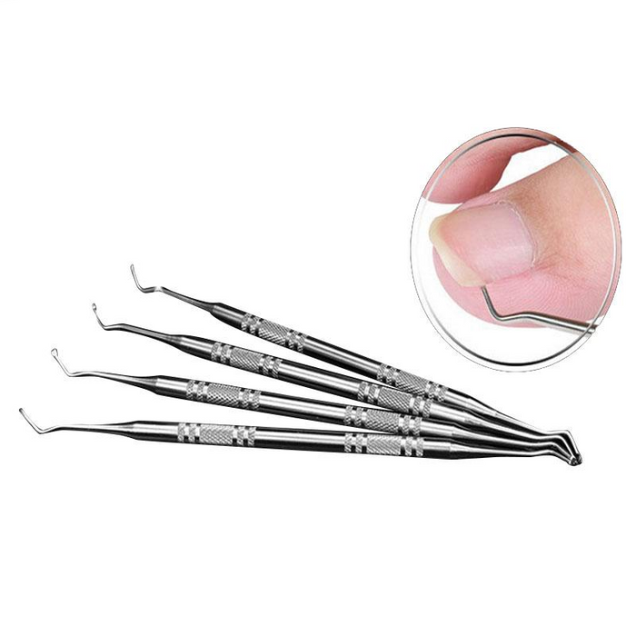 Ingrown Toe Nail Correction Lifter Pedicure
