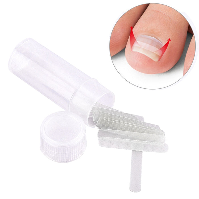 Ingrown Toe Nail Correction Sticker Pedicure
