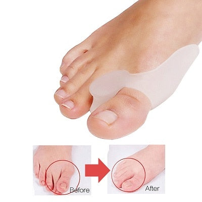 1Pcs Big Toe Stretcher Pedicure
